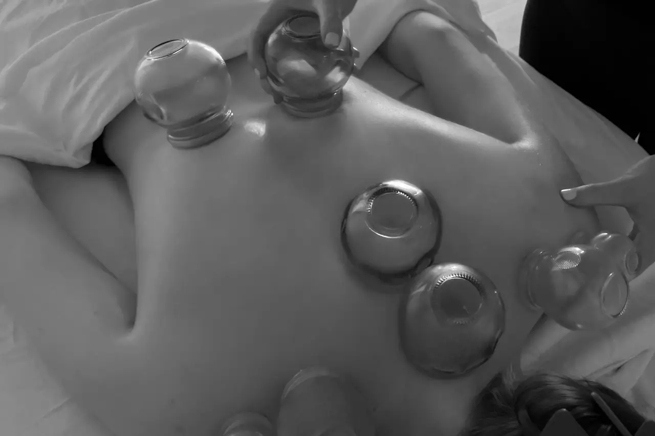 cupping 