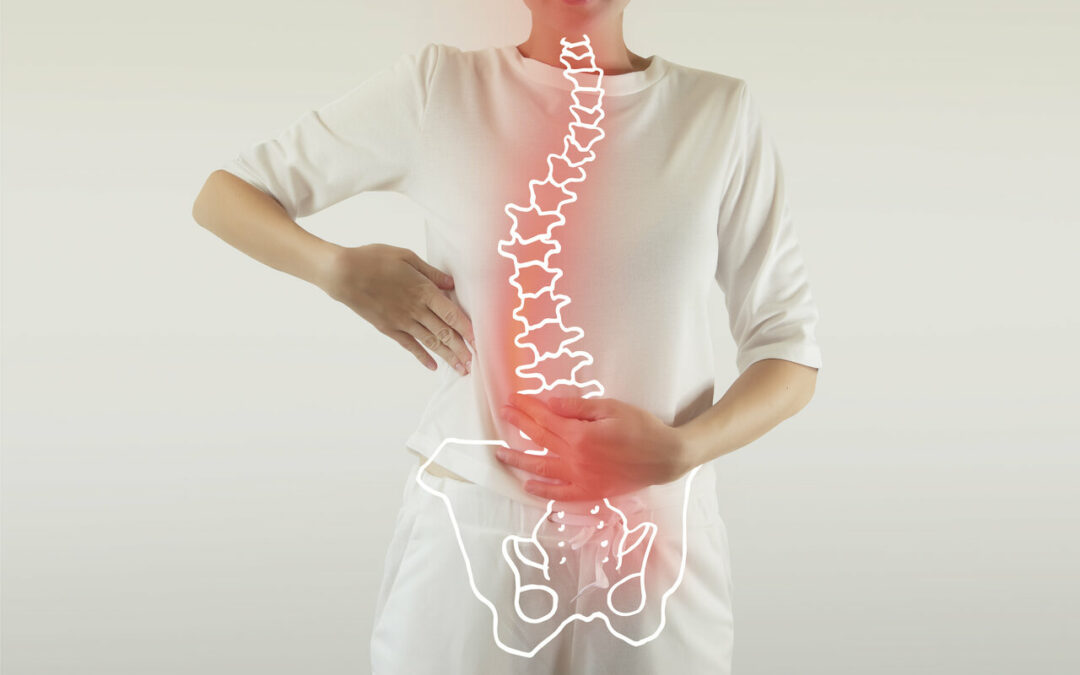 Walking Tall: How Physiotherapy Can Improve Scoliosis Symptoms